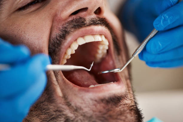 Best Knocked-Out Tooth Emergency  in West Portsmouth, OH