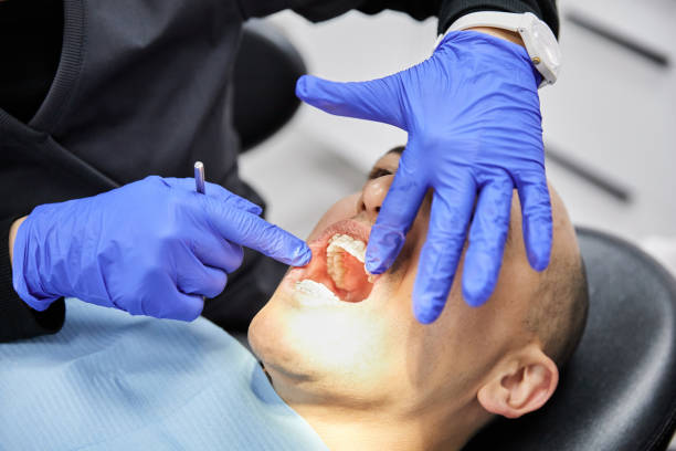 Best Teeth Whitening  in West Portsmouth, OH