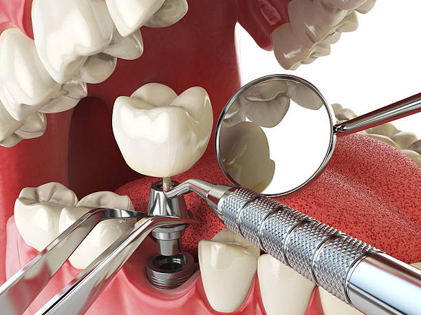 Best Urgent Tooth Repair  in West Portsmouth, OH